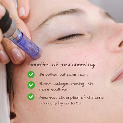 Electric Microneedling Pen - Acne Scar Treatment