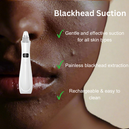 Blackhead Removal effective treatment tool - Blackhead removal suction